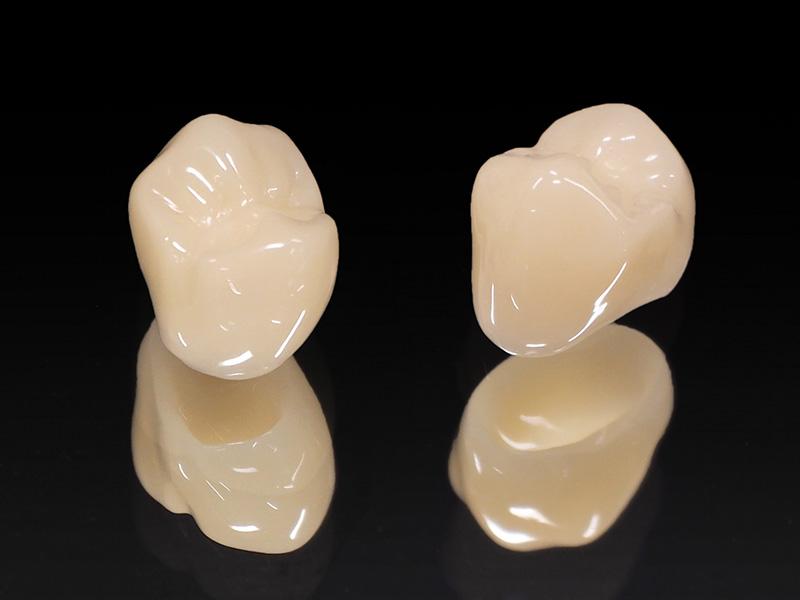 補綴治療について